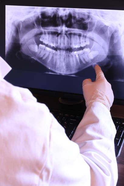 Best Emergency Root Canal Treatment in Stilwell, OK
