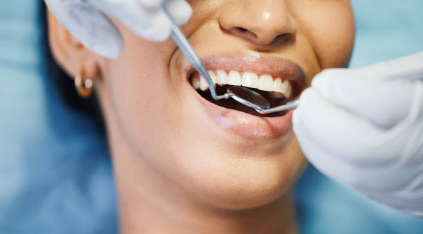 Best Emergency Tooth Extraction in Stilwell, OK